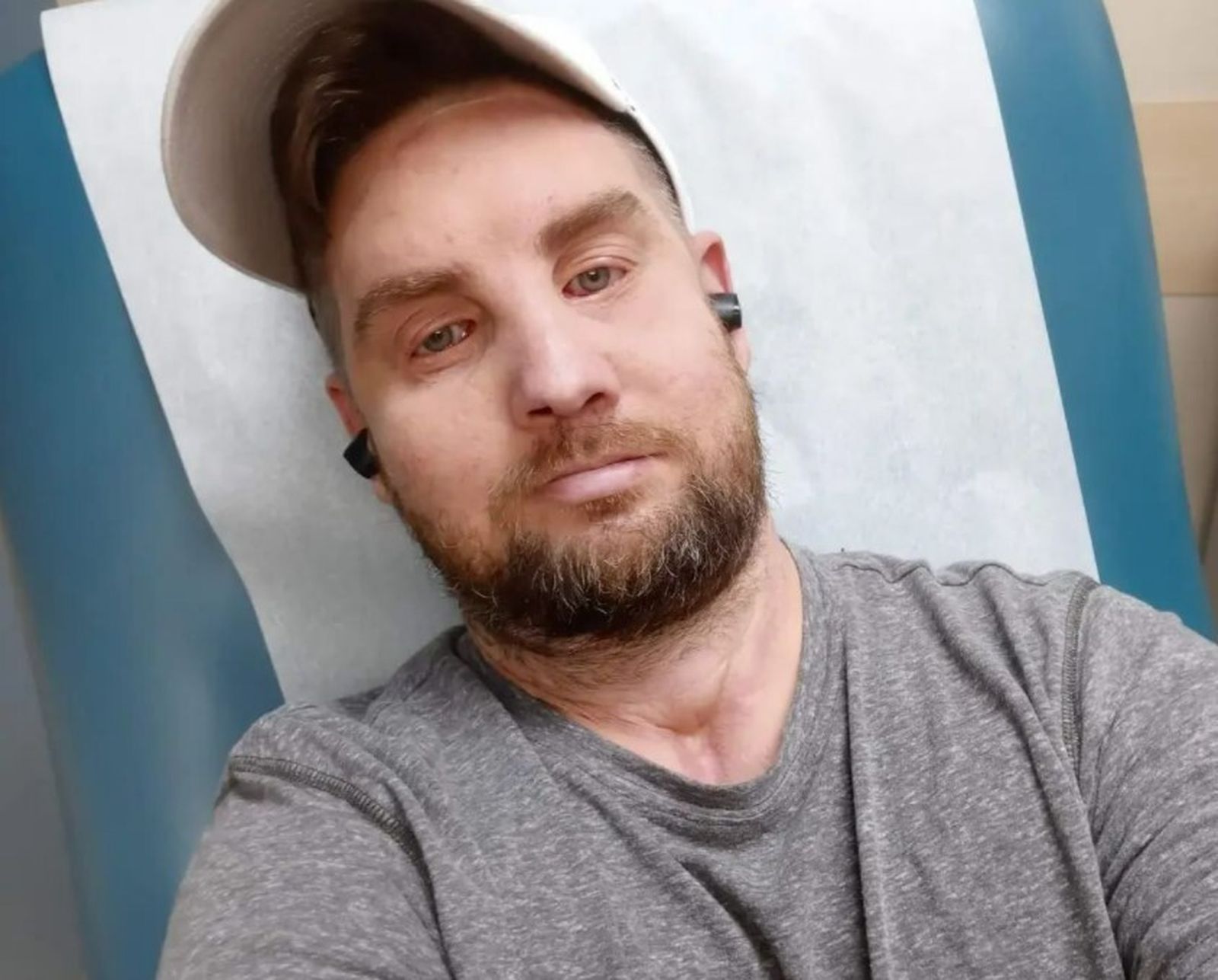 Mitch Hunter muestra su nuevo rostro  en sus redes sociales.