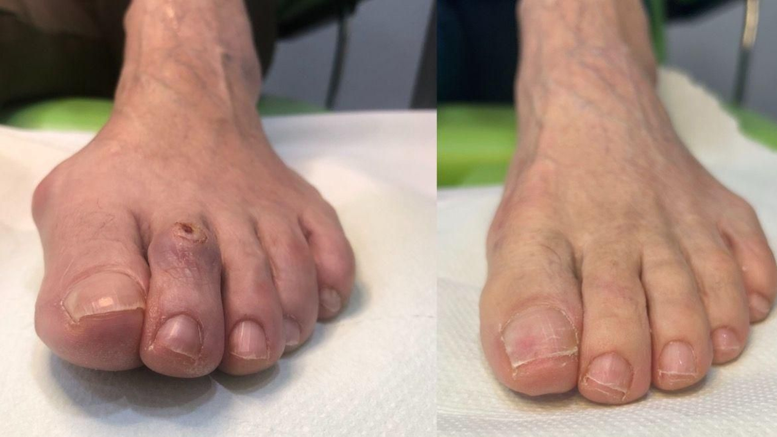 Antes y después de una intervención.