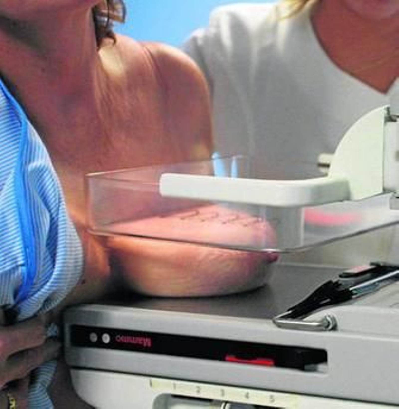 Una mujer se somete a una prueba de mamografía.