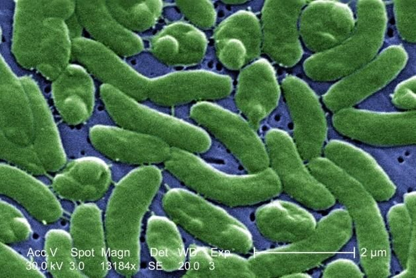 La bacteria 'Vibrio vulnificus' en una imagen de microscopio colorada.