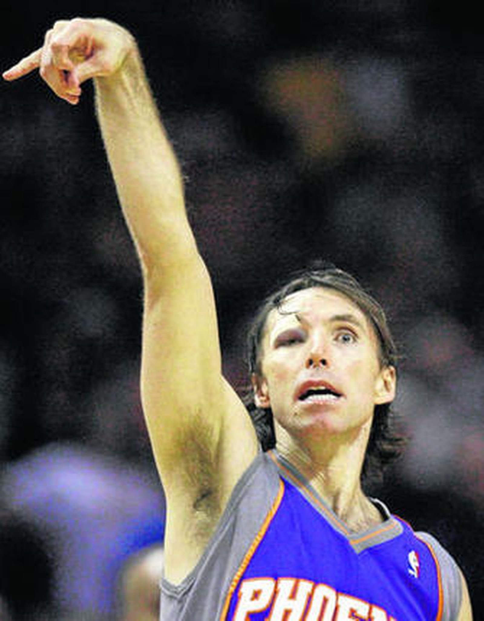 Imagen del canadiense después de desfigurarse el rostro jugando contra los Spurs.