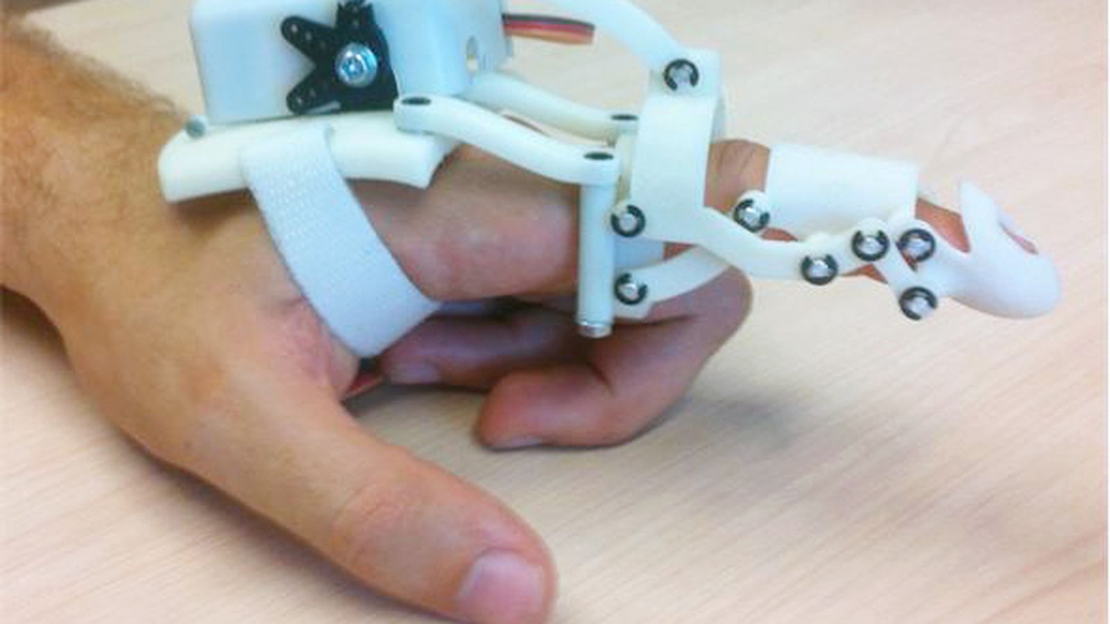 Prototipo de la prótesis ortopédica