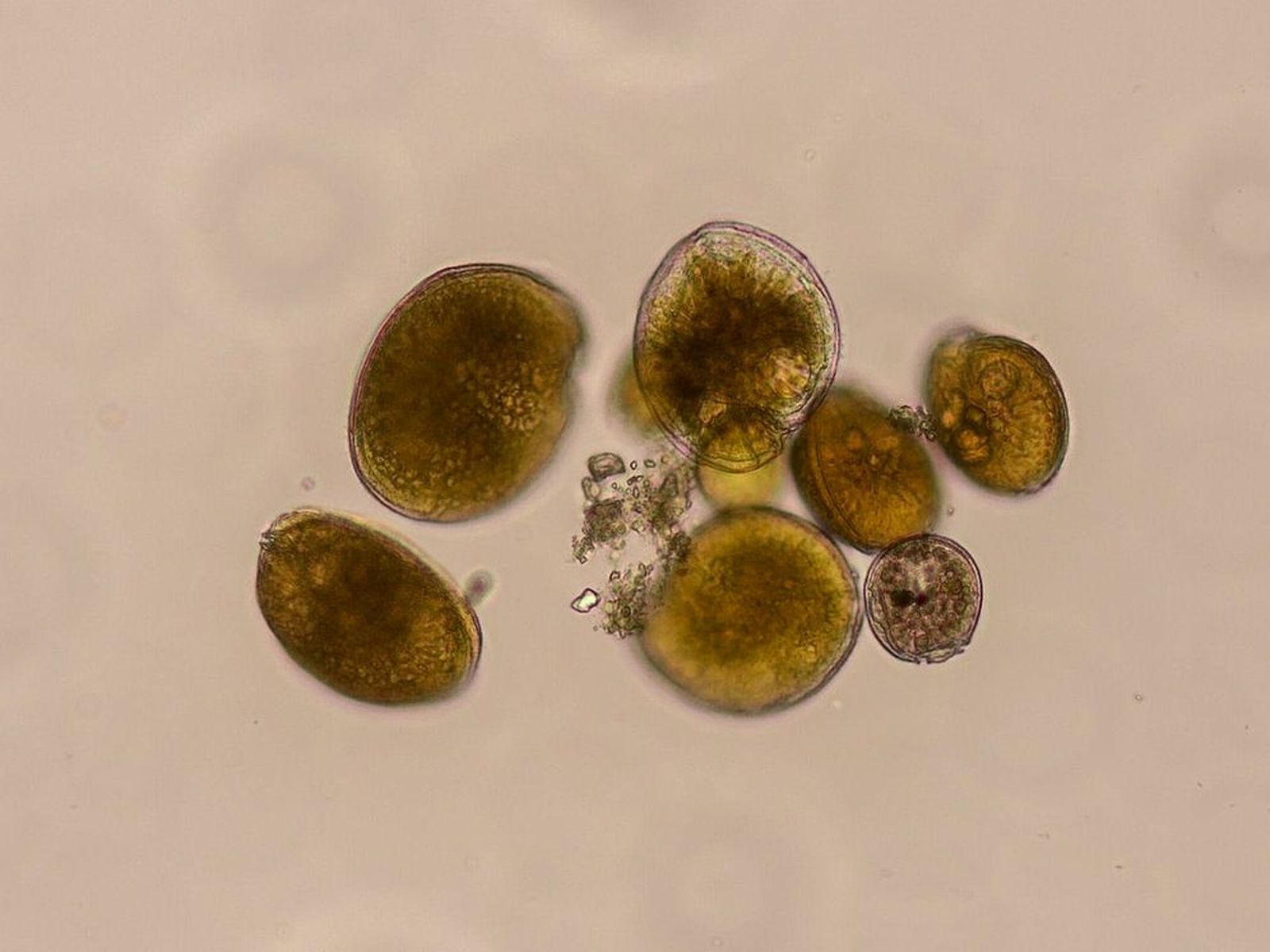 Detectan una microalga productora de ciguatoxinas en aguas del mediterráneo peninsular