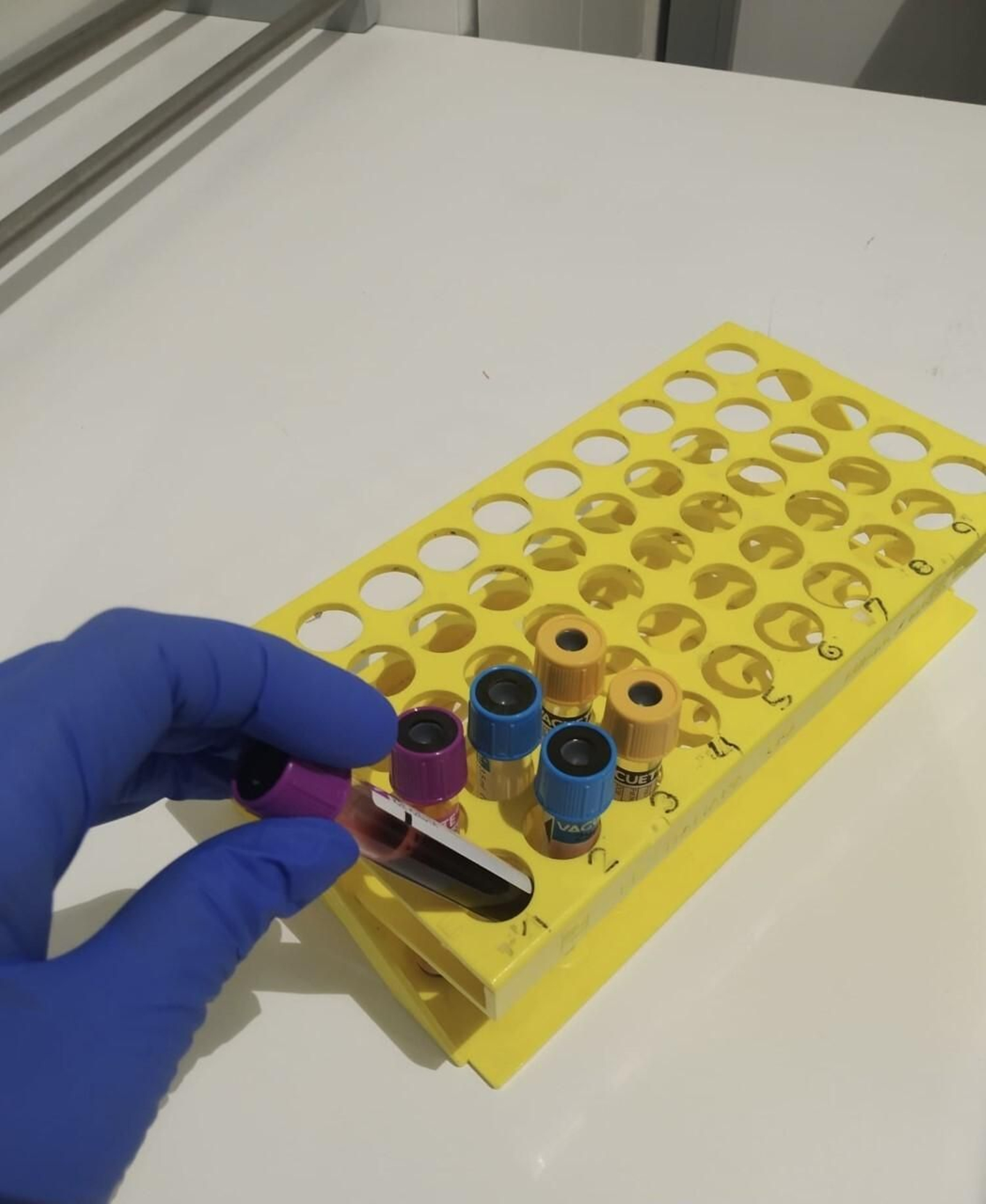 Un sanitario trabajando con muestras.