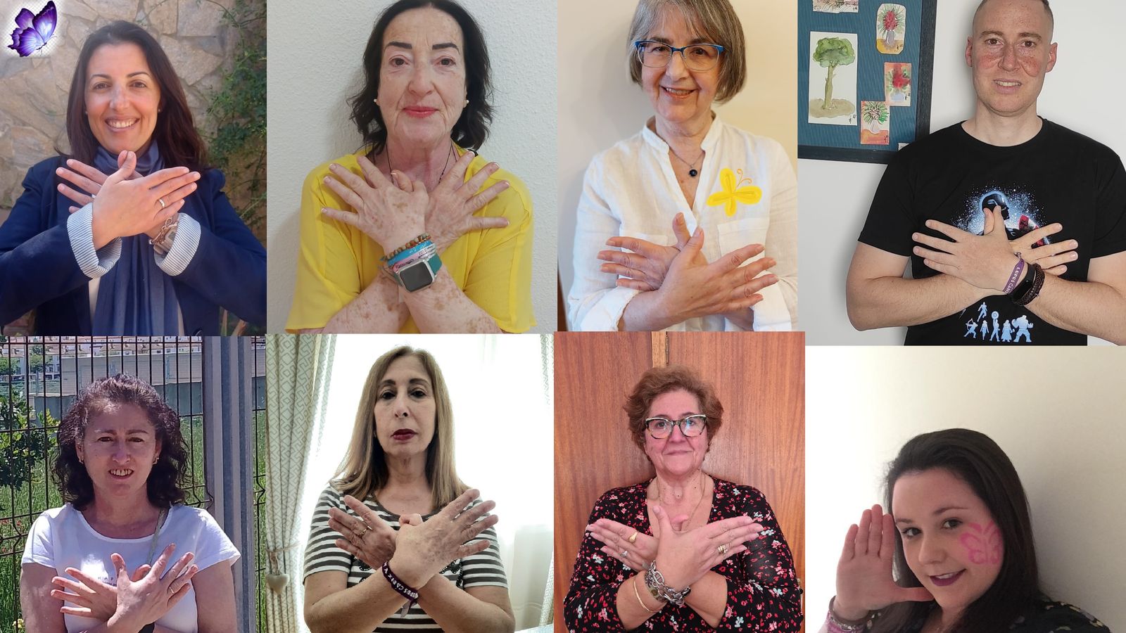 Pacientes con lupus del Campo de Gibraltar hacen el gesto de la mariposa