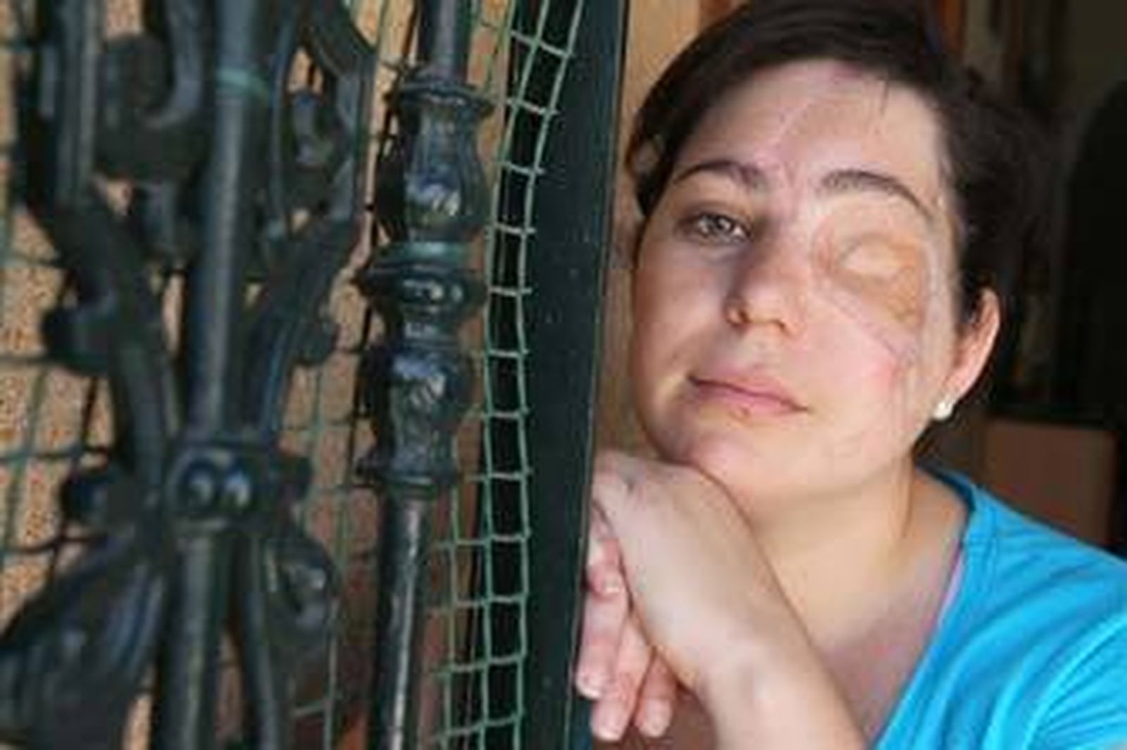 Arranca el juicio por el petardo que causó la pérdida de un ojo