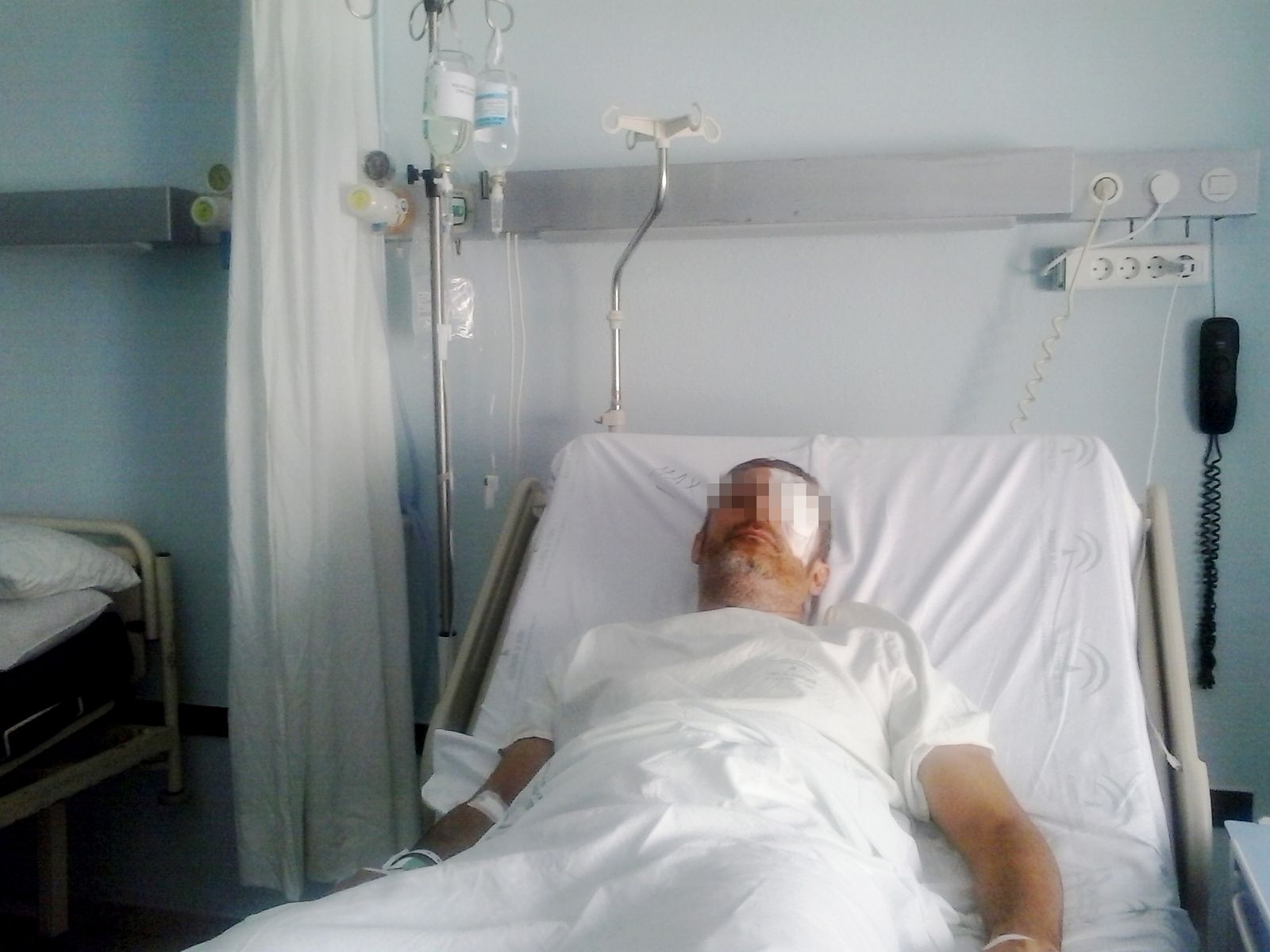 Salva un ojo de milagro tras una paliza en Pueblo Nuevo