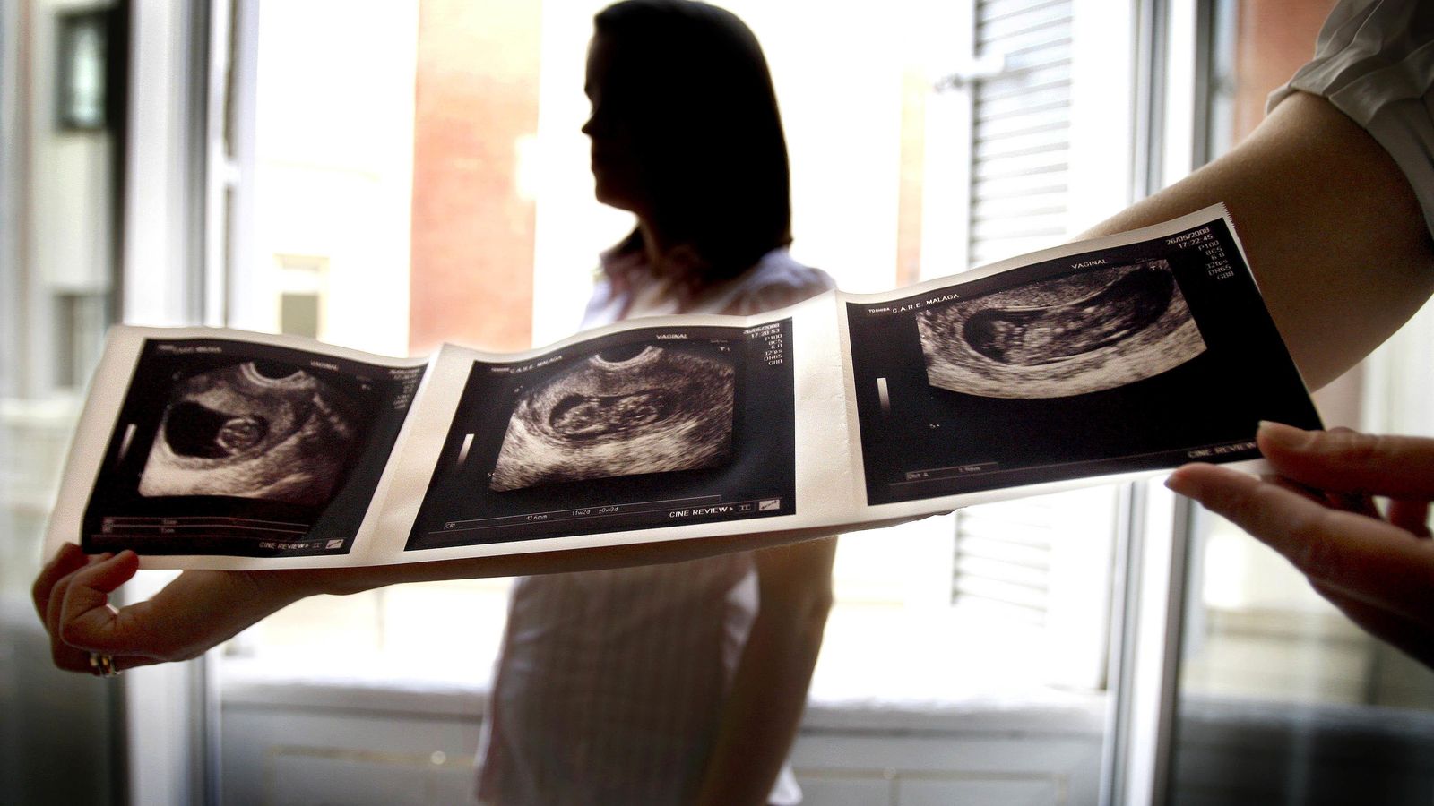 Las ecografías también son necesarias.