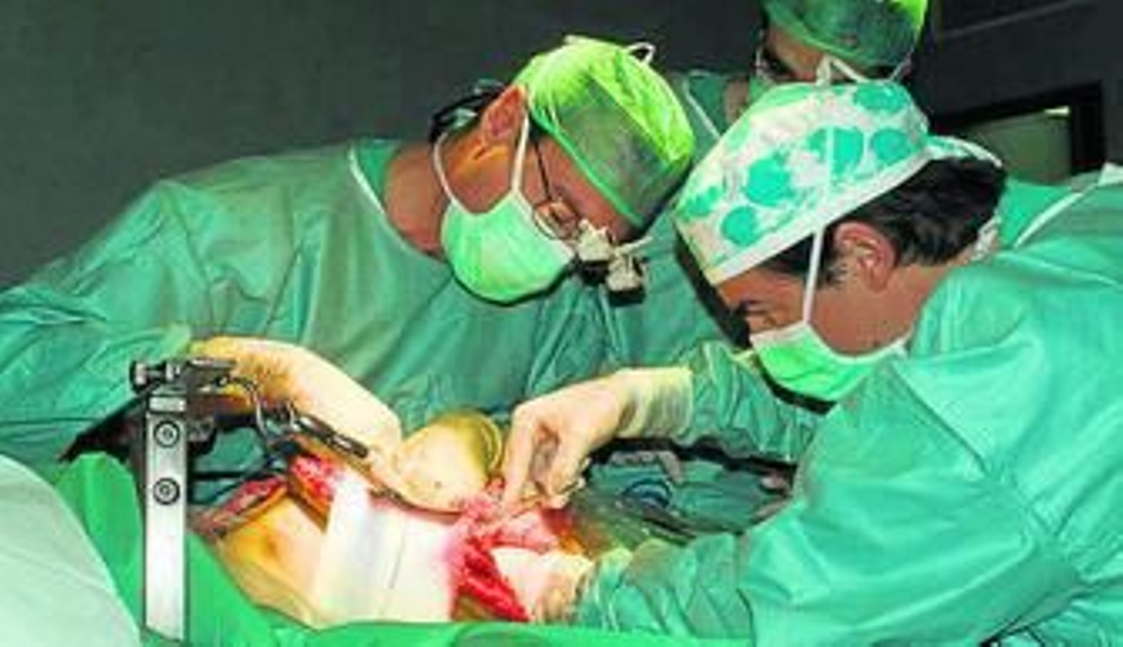 Los cirujanos durante una de las intervenciones quirúrgicas.