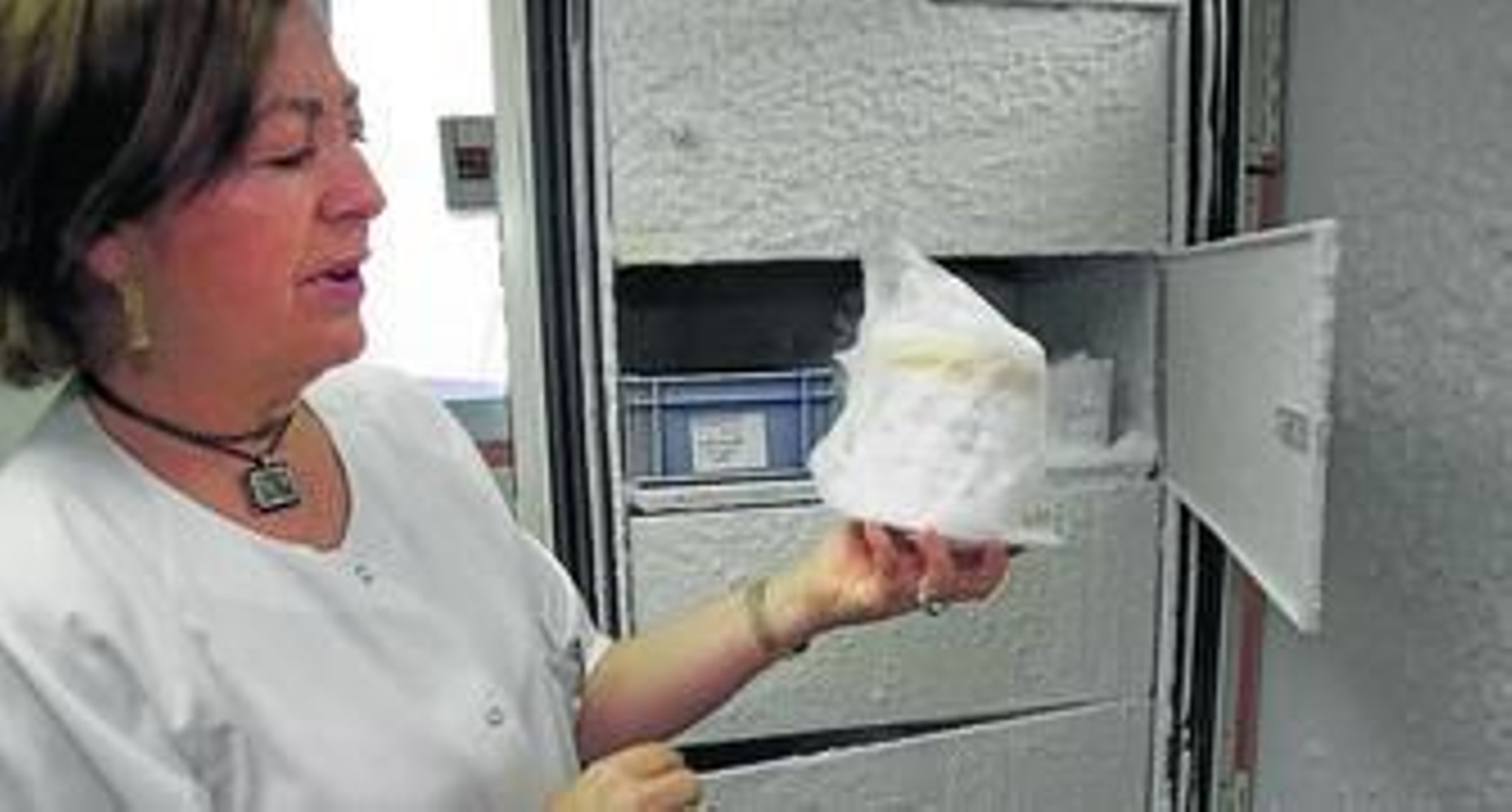 Los huesos y tejido osteotendinoso se almacenan en congeladores a menos 80 grados centígrados con doble tarro de seguridad.