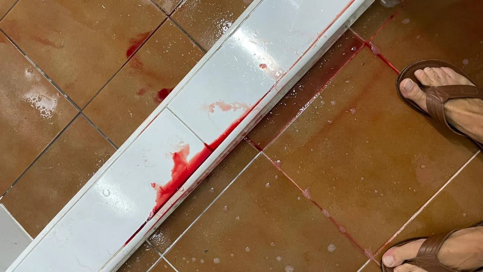 El pequeño tuvo una hemorragia provocada por una poceta mal instalada.