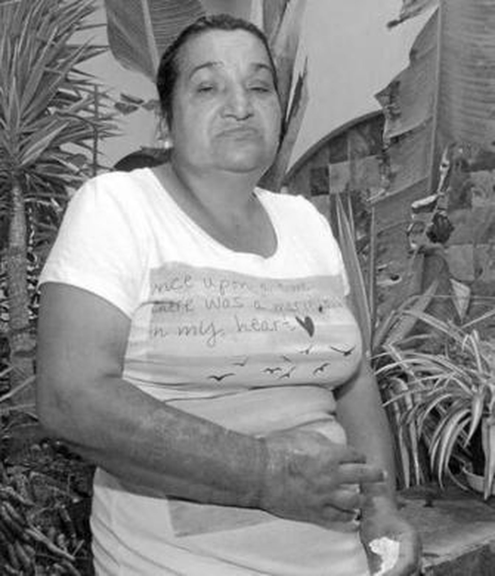 La afectada, María Luisa Fernández Acosta, muestra las secuelas que la vía mal puesta le dejó en el brazo.