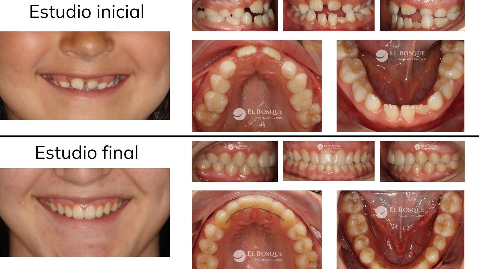 Estudios de ortodoncia.