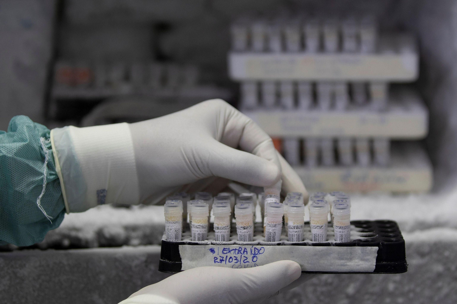 Investigación en la Universidad de Granada: Devuelven la vista a ratas ciegas gracias a una retina artificial que se inyecta en el ojo Investigación en la Universidad de Granada: Devuelven la vista a ratas ciegas gracias a una retina artificial que se inyecta en el ojo