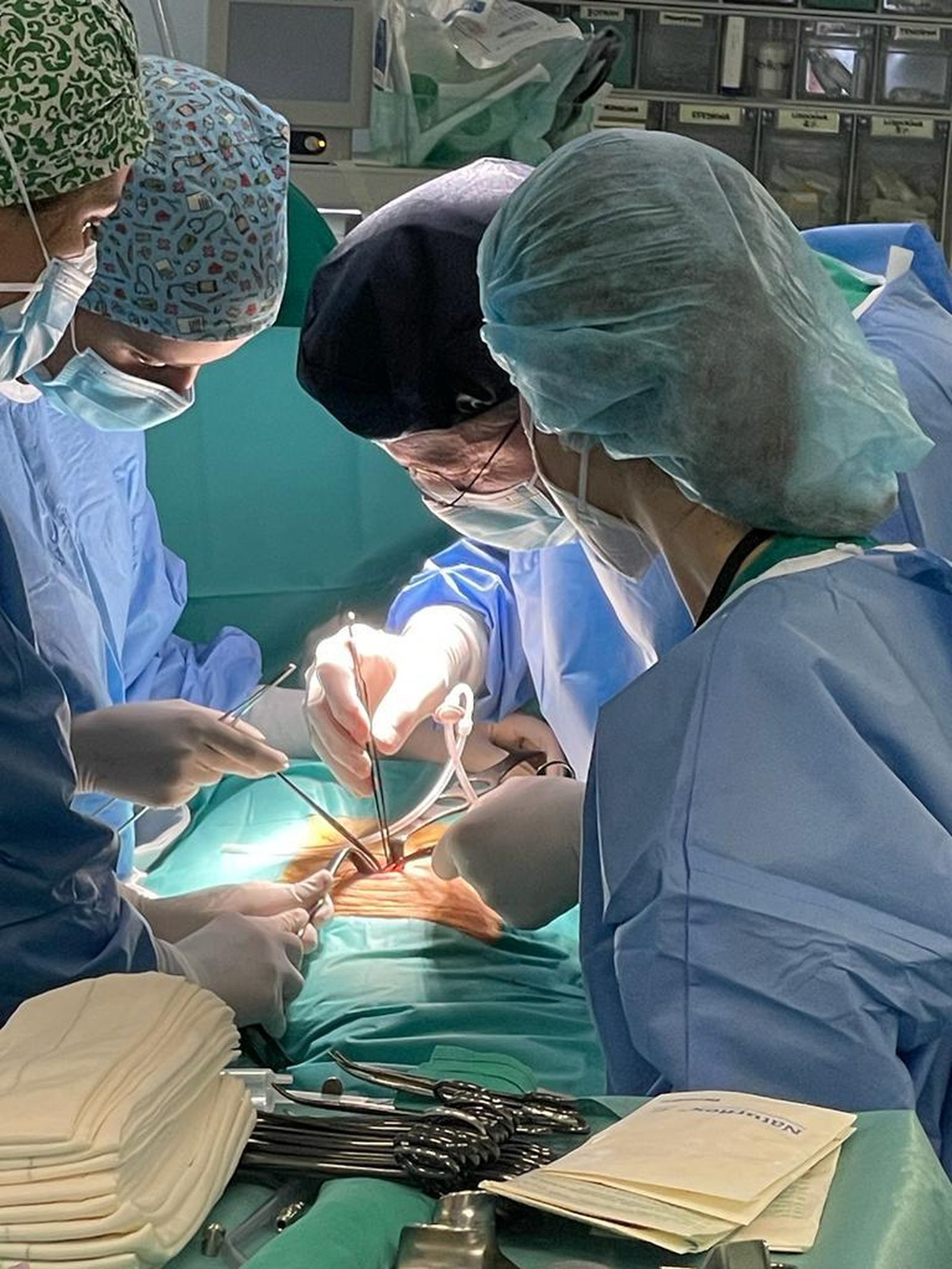 La implantación del catéter peritoneal.