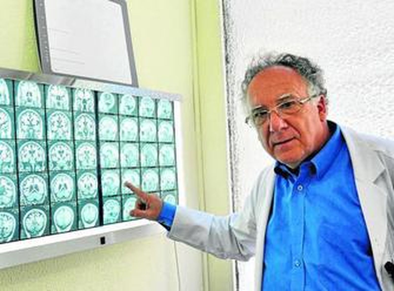 El doctor Guillermo Izquierdo es especialista en Neurología del Hospital Virgen Macarena.
