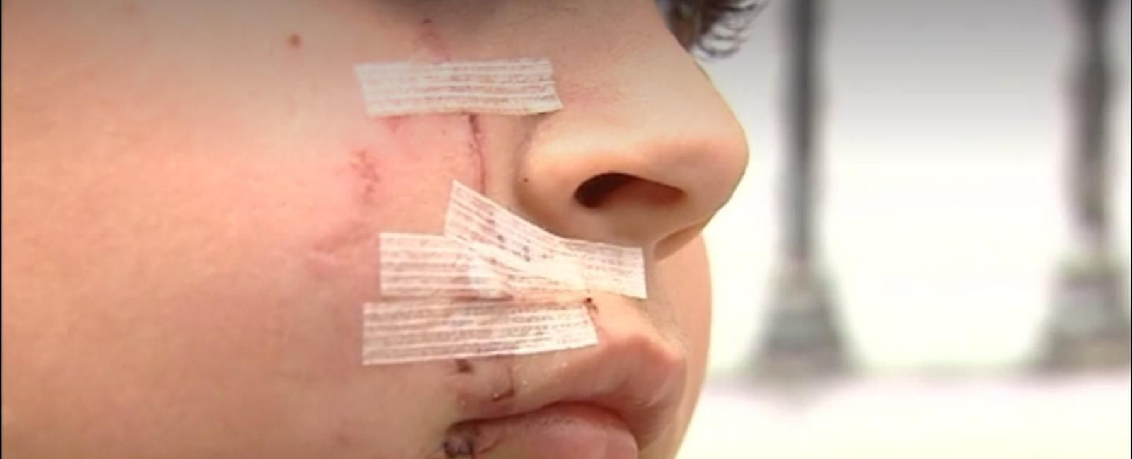 Estado en el que ha quedado el rostro del menor tras la agresión.