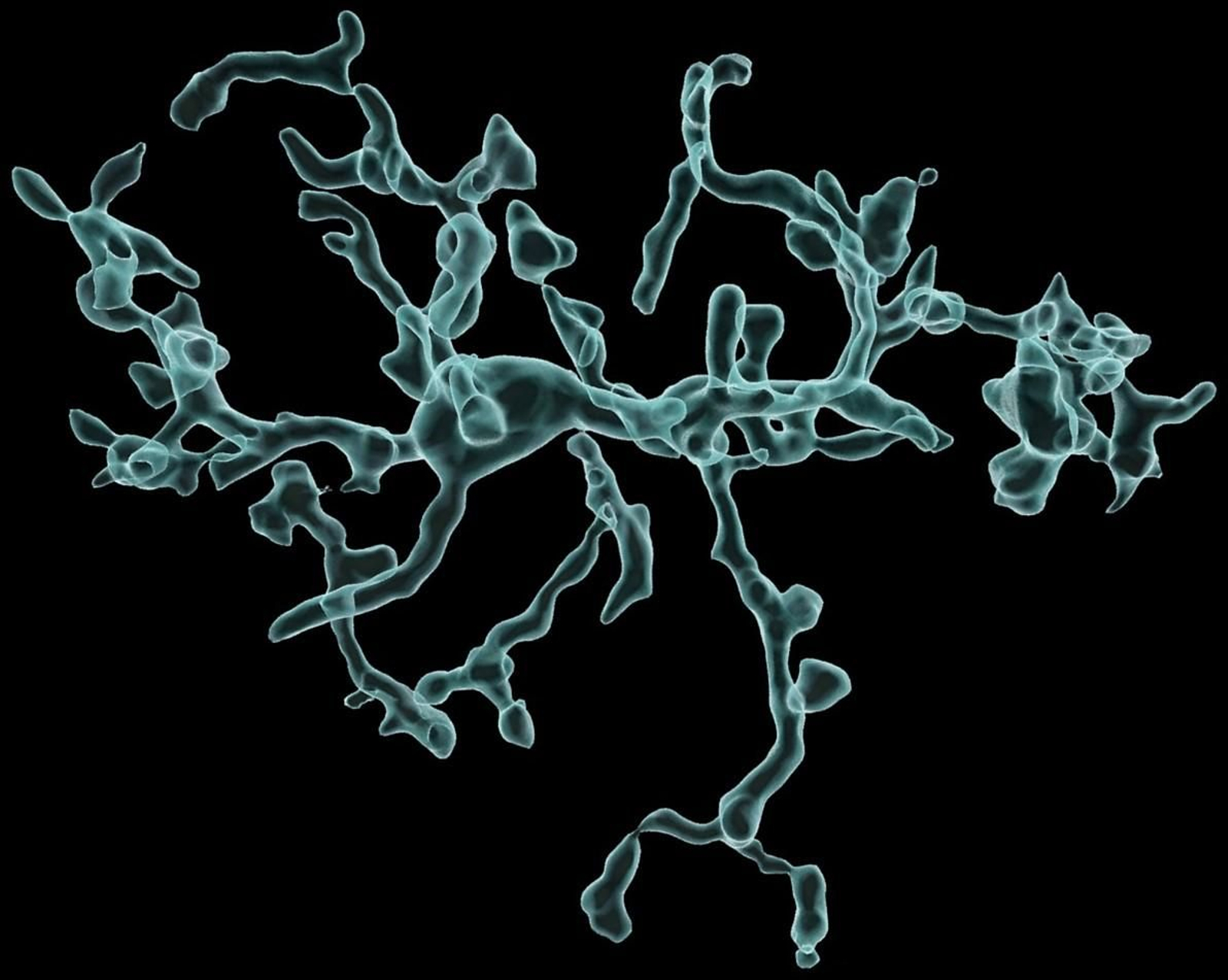 Imagen de la microglía.