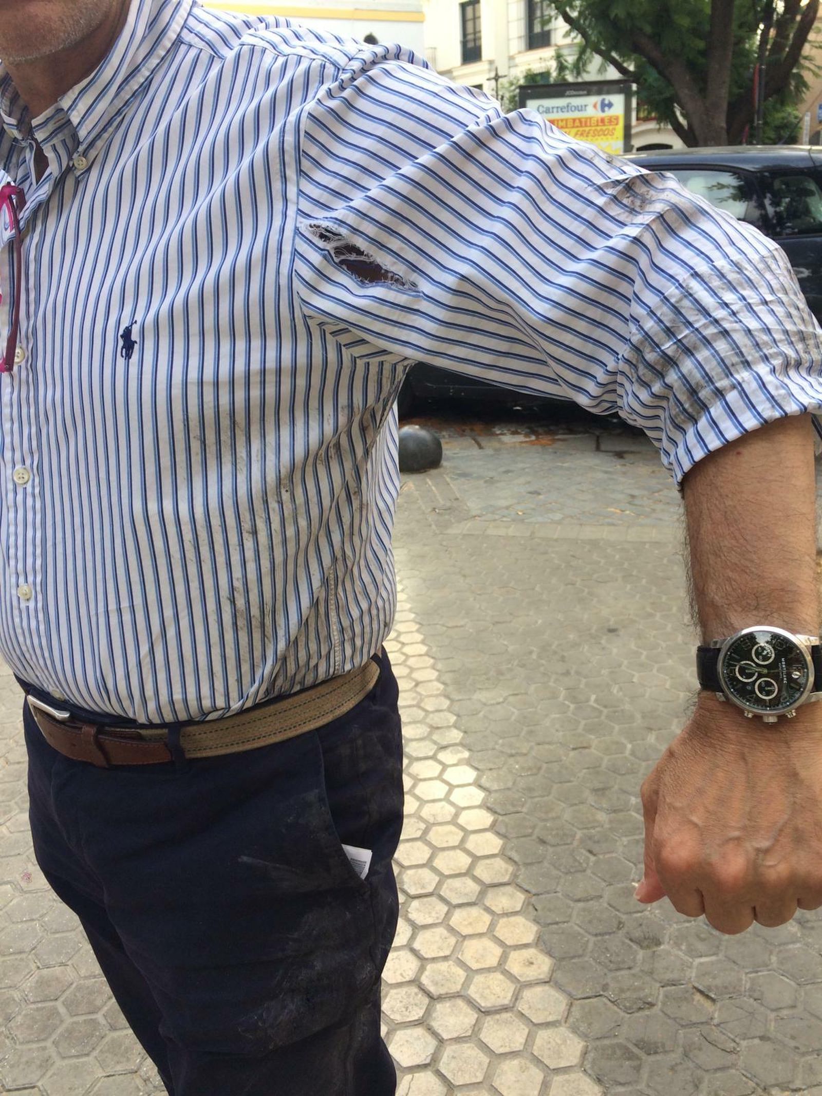 Las secuelas del accidente