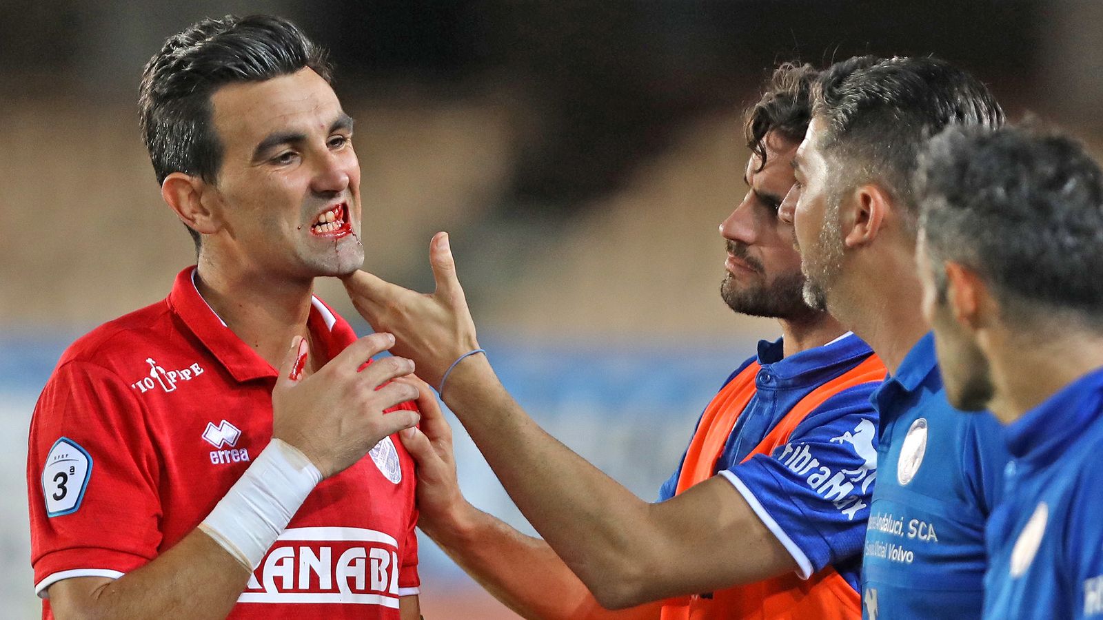 Camacho sufrió la fractura de la mandíbula en el partido con el Cabecense.