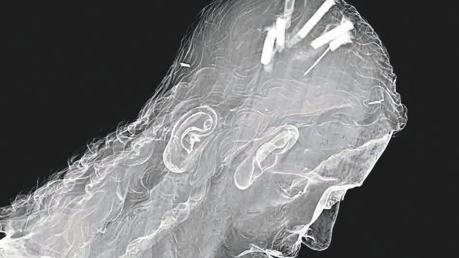 Imagen lateral del busto de Jesús Nazareno, tomada en el TAC.