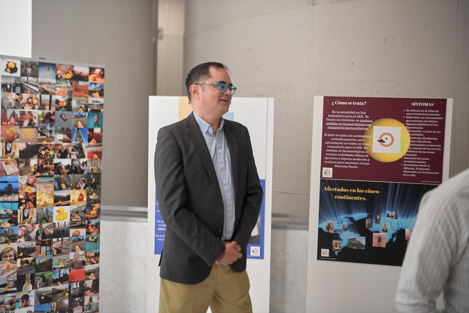 Exposición ‘Convivir con el síndrome Camurati-Engelmann’