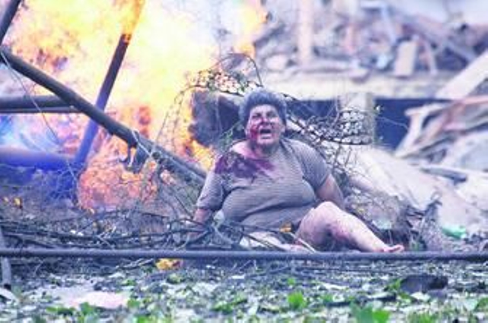 Una de las imágenes que dieron la vuelta al mundo fue la de esta mujer herida en el bombardeo ruso sobre Gori.