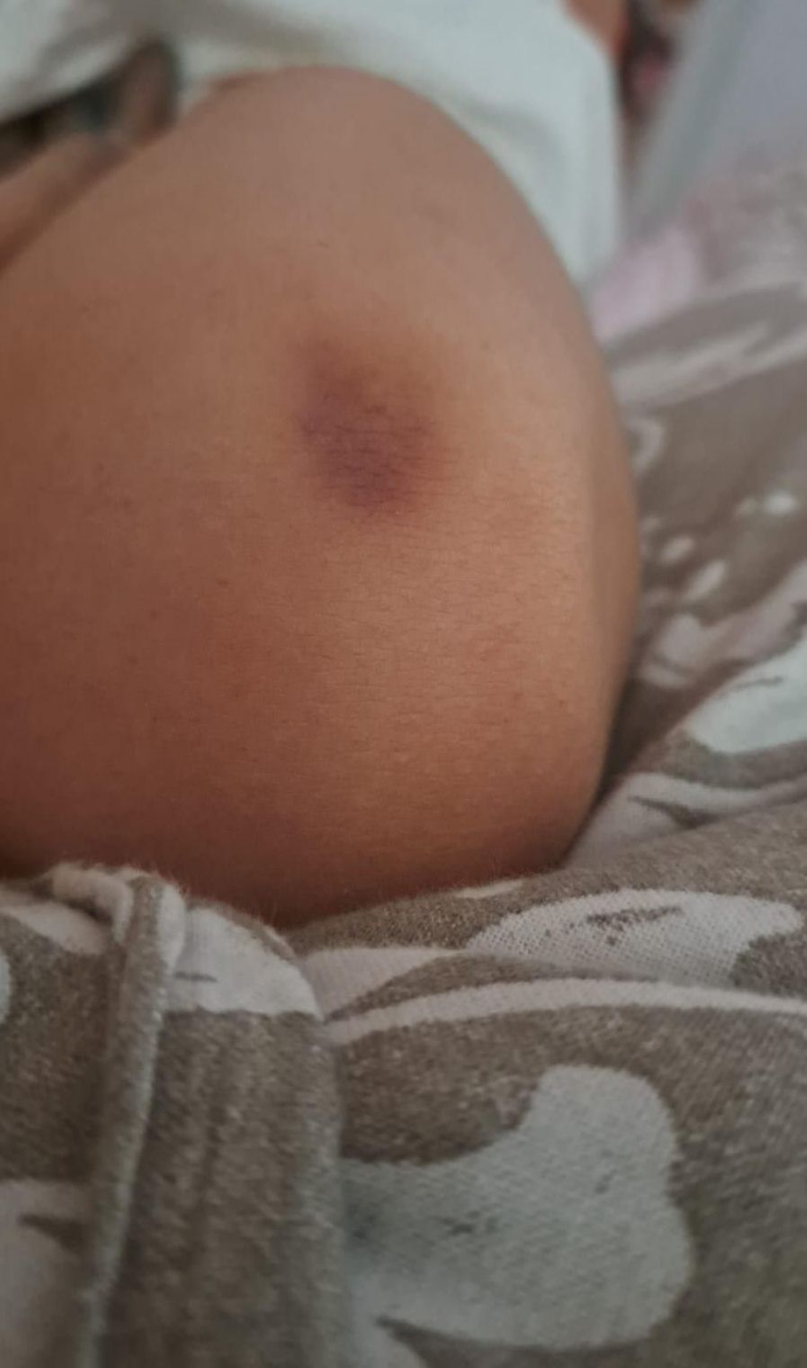 Otra de las fotografías aportada a la denuncia de la Guardia Civil.