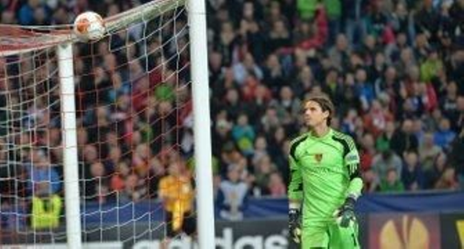 Rayos X al cerrojo alemán