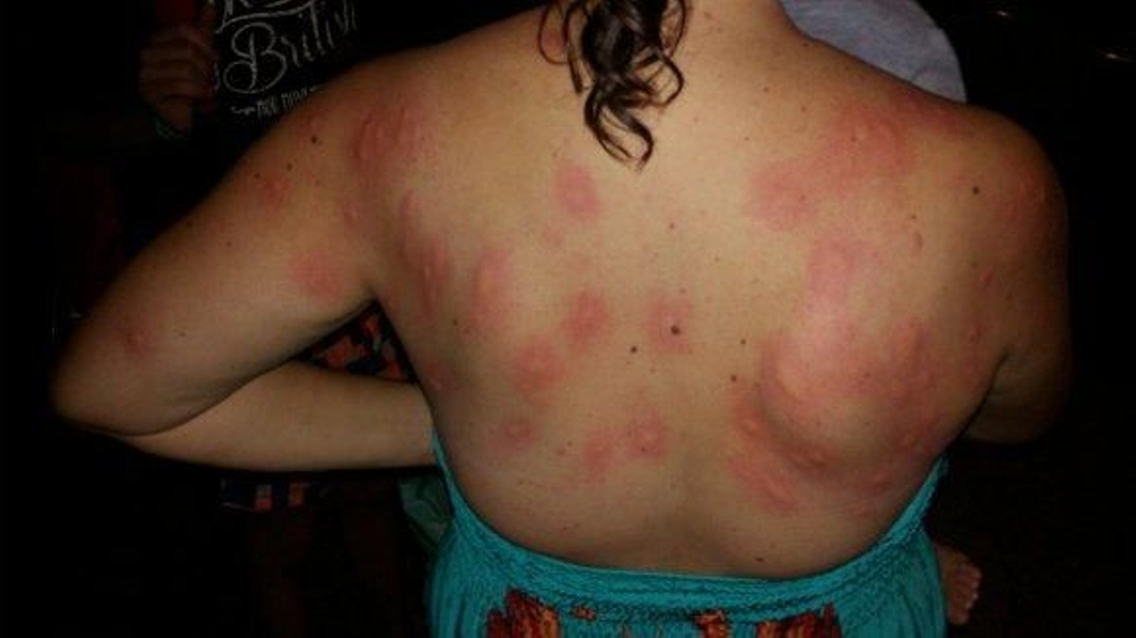 Una nueva plaga de mosquitos sorprende a los bañistas en la Playa de la Misericordia