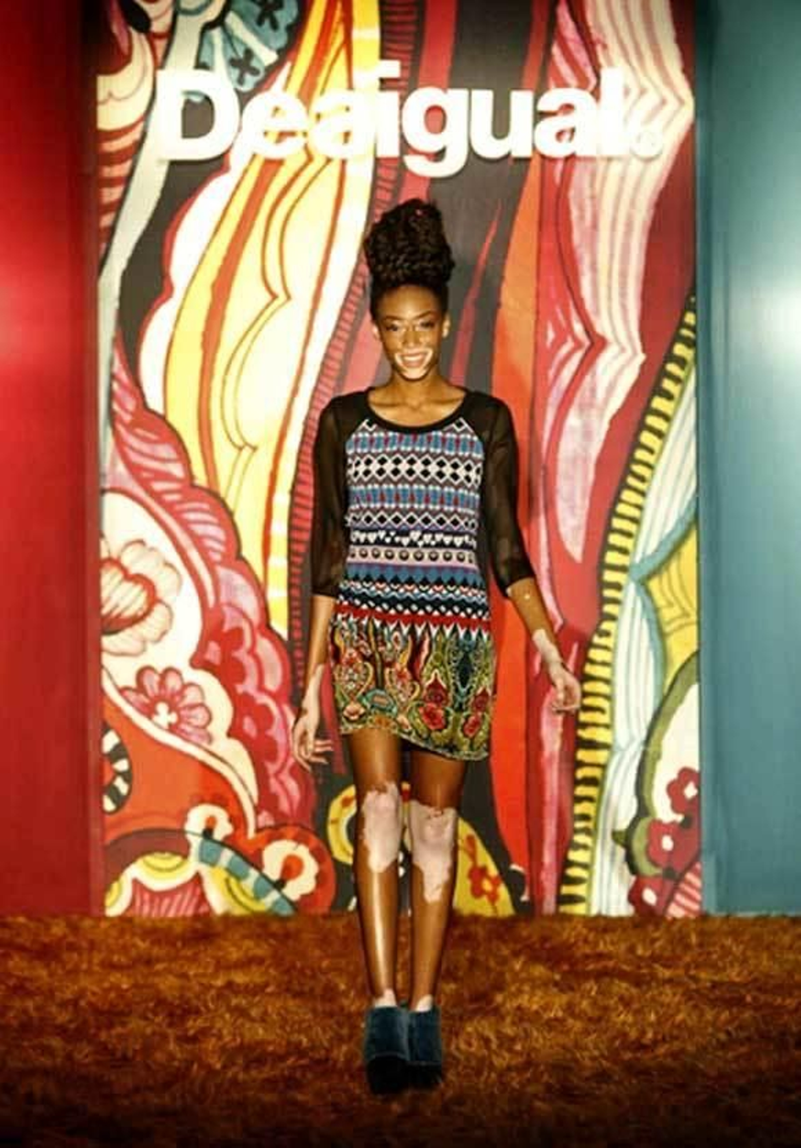 Winnie Harlow, nada que esconder