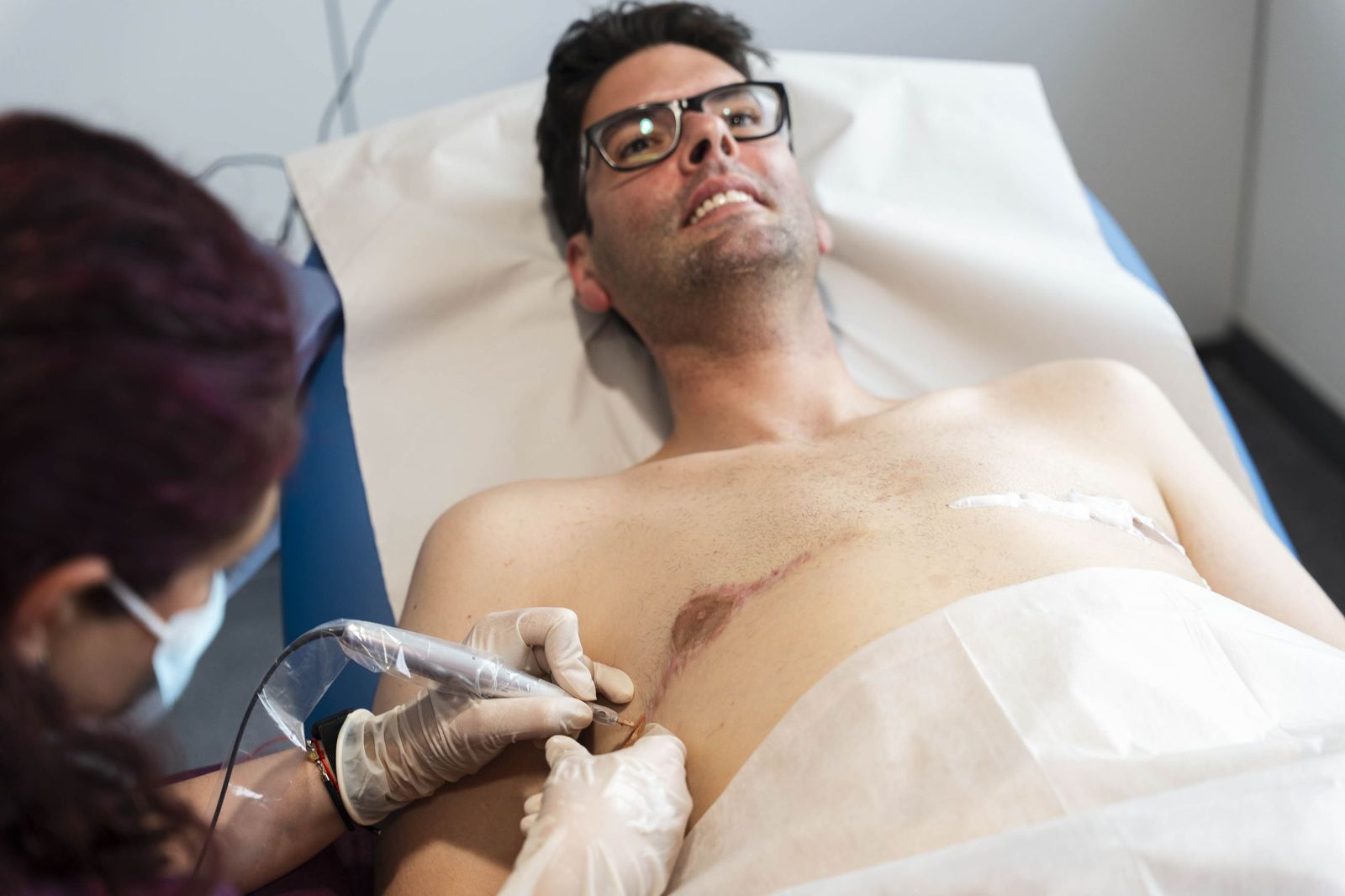 Tratamiento de micropigmentación por mastectomía en un hombre, en imágenes