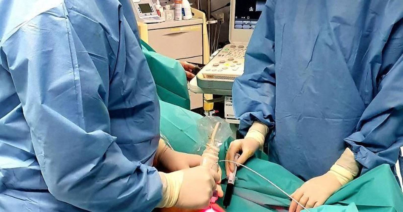 Técnica del endoláser.