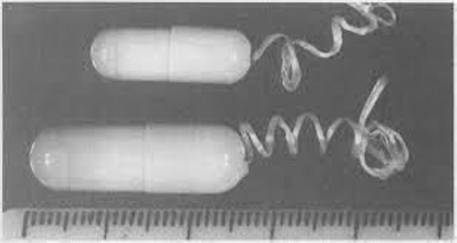 Descubren un nuevo método poco invasivo como alternativa a la endoscopia superior