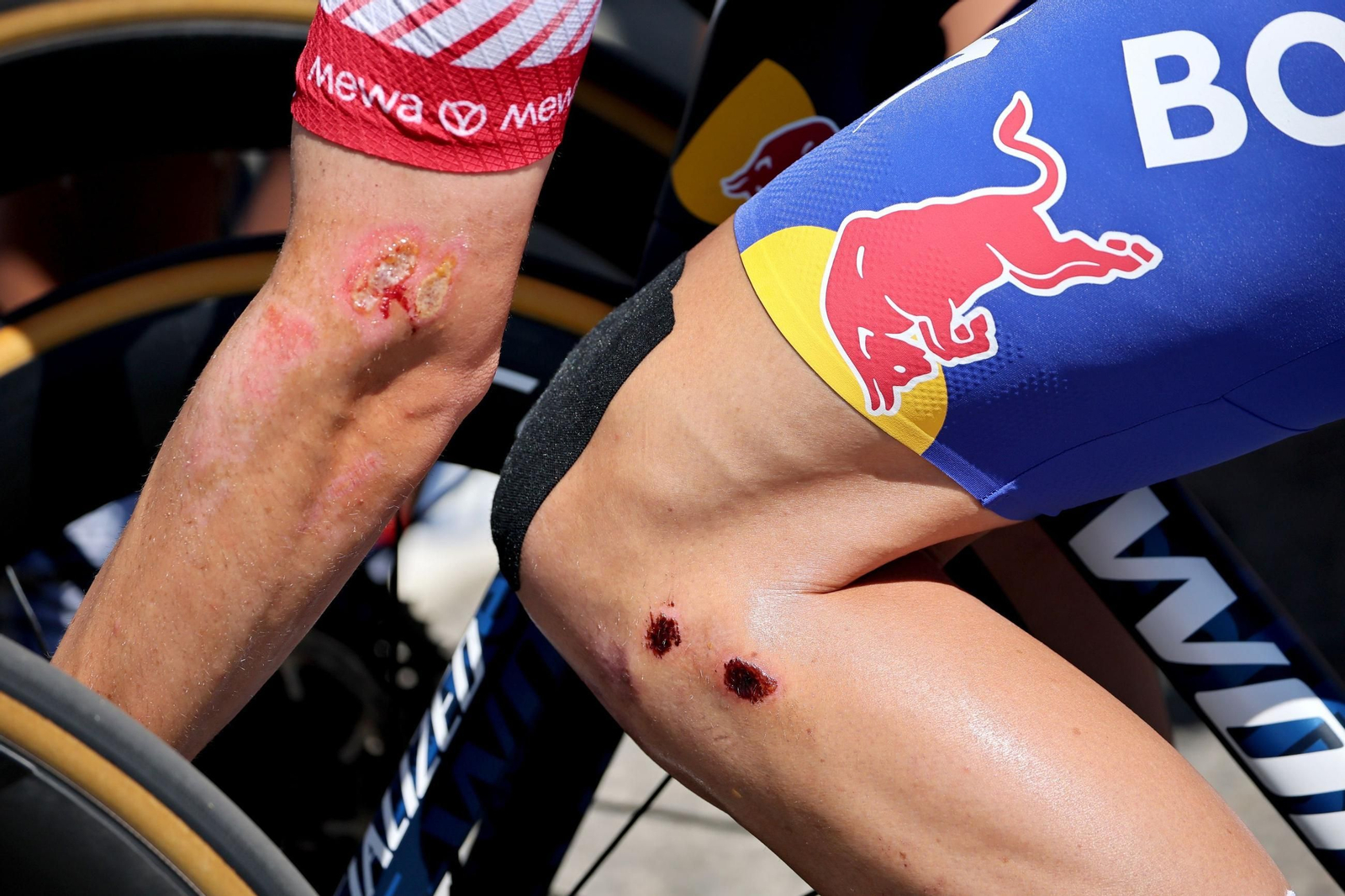 Las mejores fotos del Tour de Francia | Etapa 11