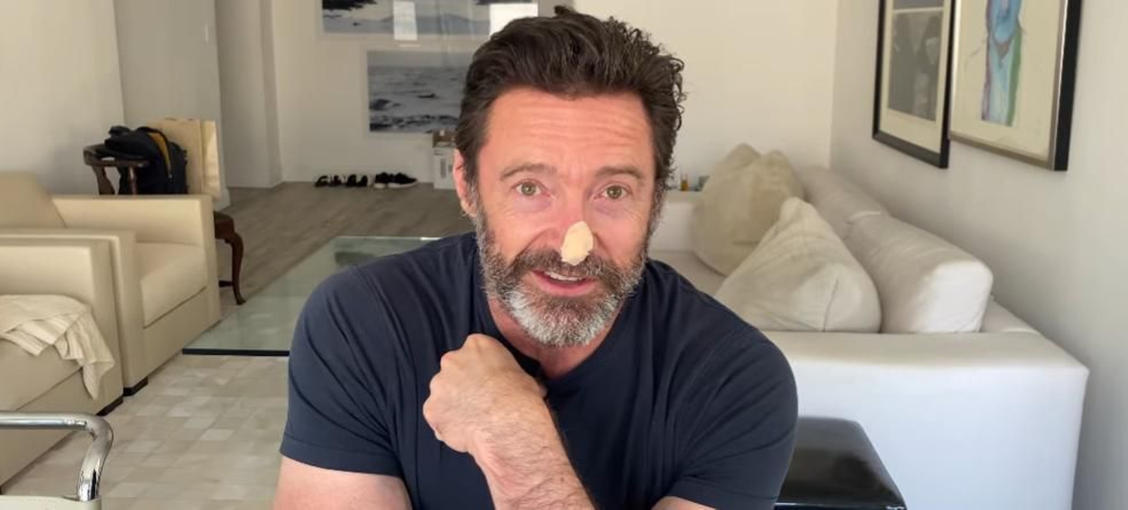 Huhg Jackman: el ejemplo de cómo se manifiestan los diferentes tipos de cáncer de piel debido a la radiación solar