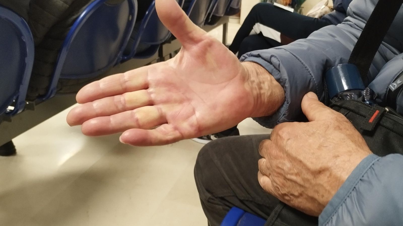 Críspulo Casado tiene un problema en los tendones de una mano. Críspulo Casado tiene un problema en los tendones de una mano.
