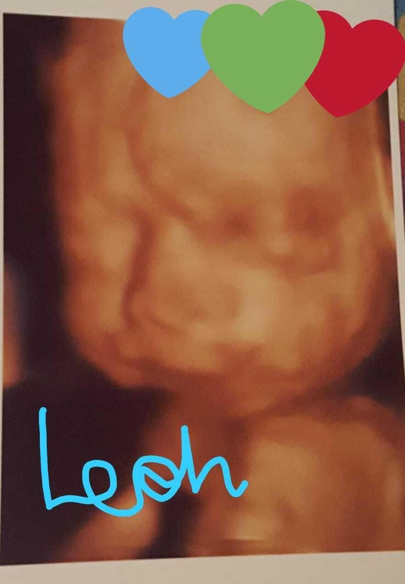 Imagen ecográfico de Leoh, el hijo de Sonia, que falleció al poco de nacer.