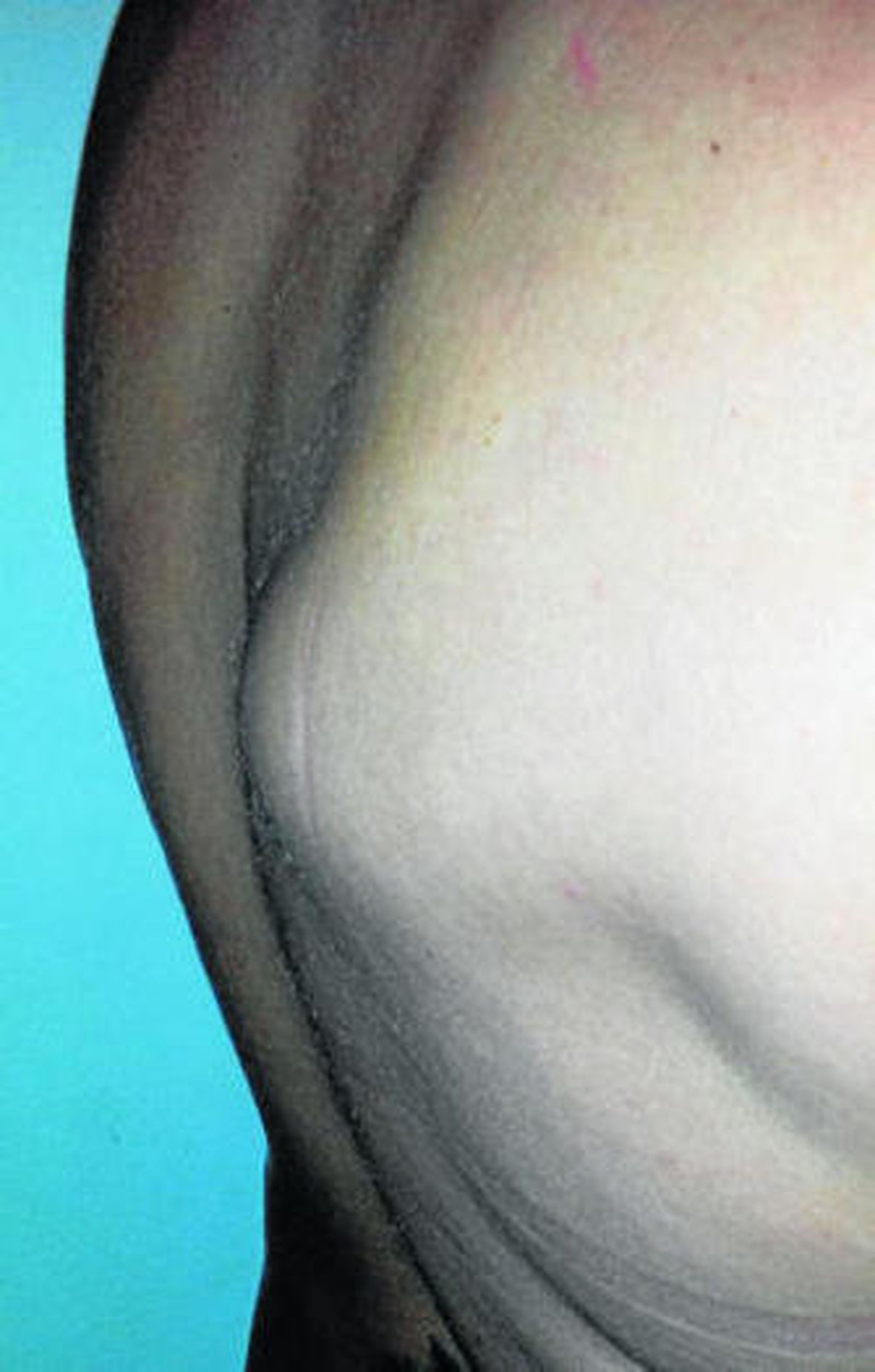 Imagen del estado en el que se encuentra el lado derecho de María Jesús Martín.