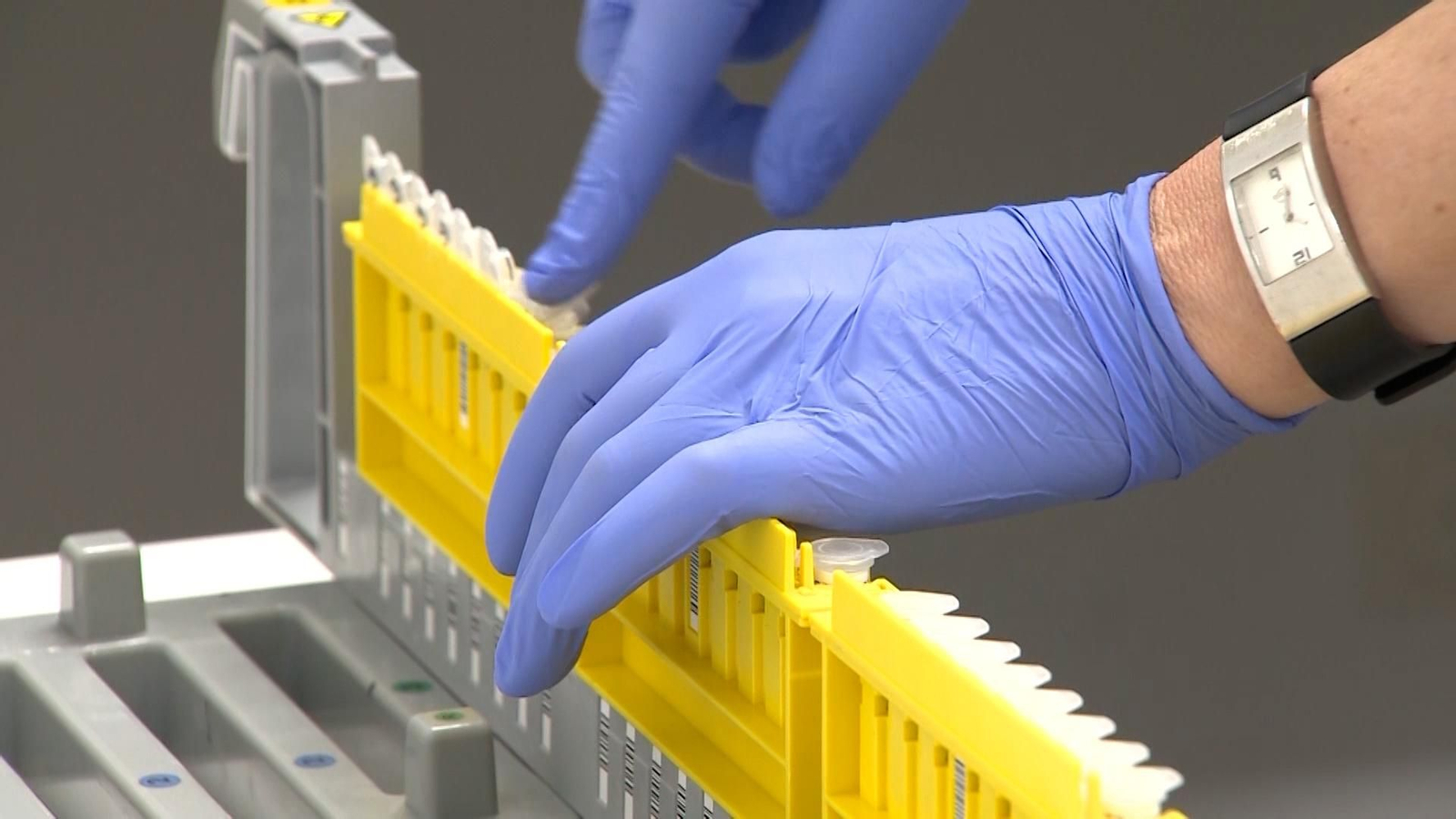 Vacunas contra la viruela del mono (mpox).