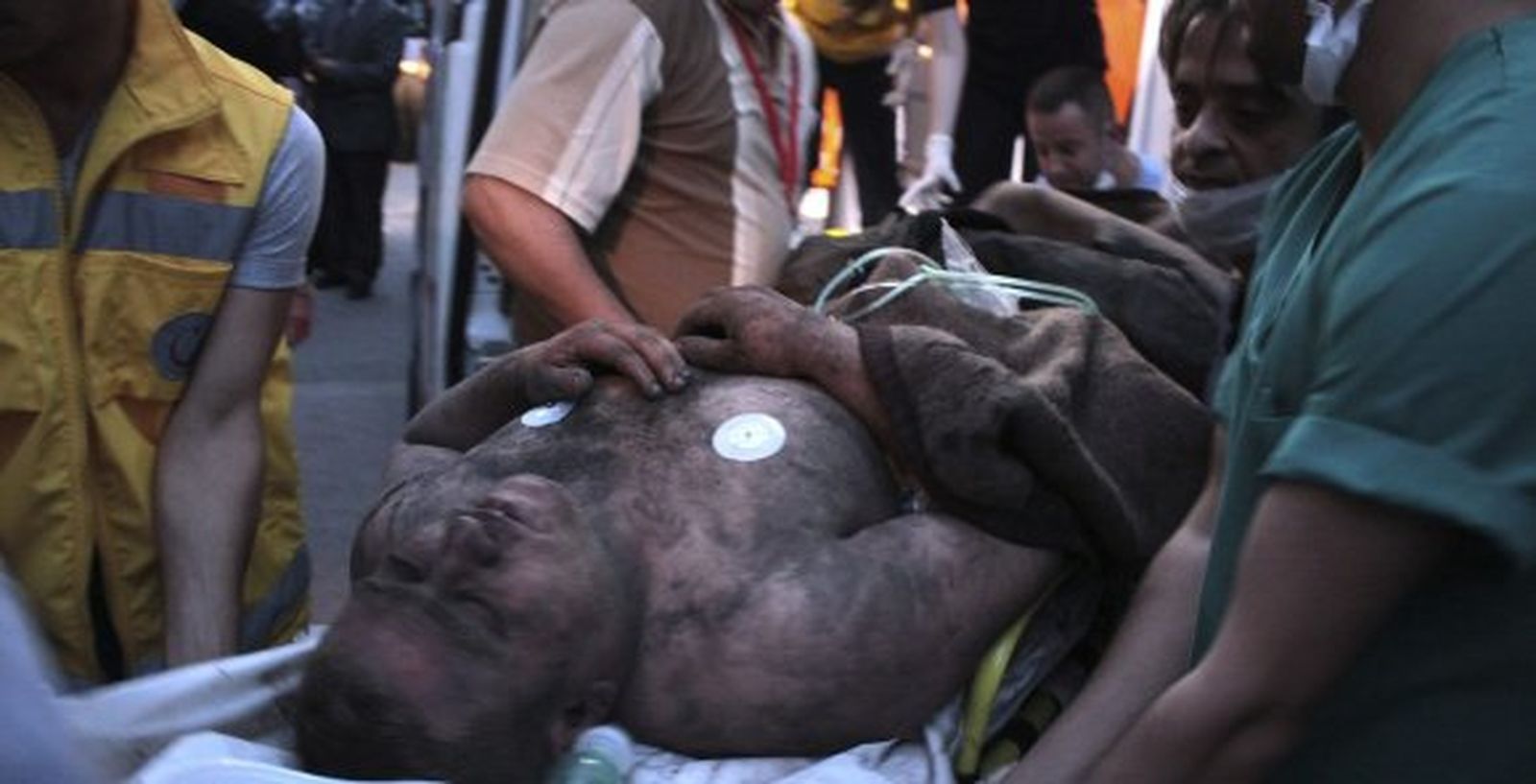 El peor desastre minero de la historia de Turquía crea tensión en el país