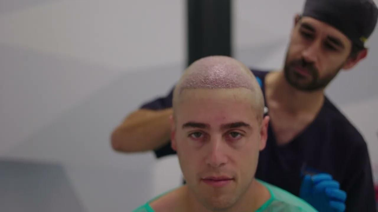 Clinical Capilar Frontela