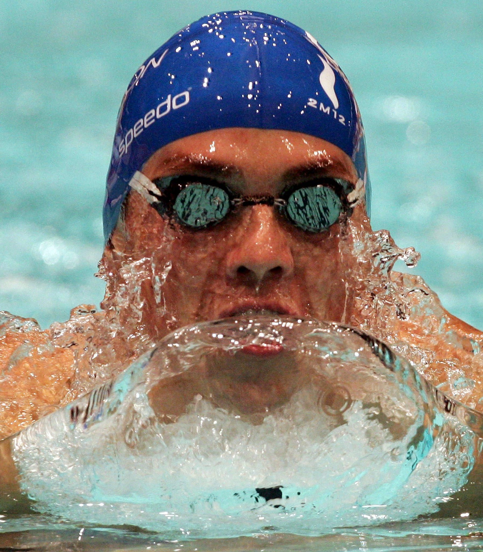 La sobreexposición al cloro en las piscinas provoca erosión dental.