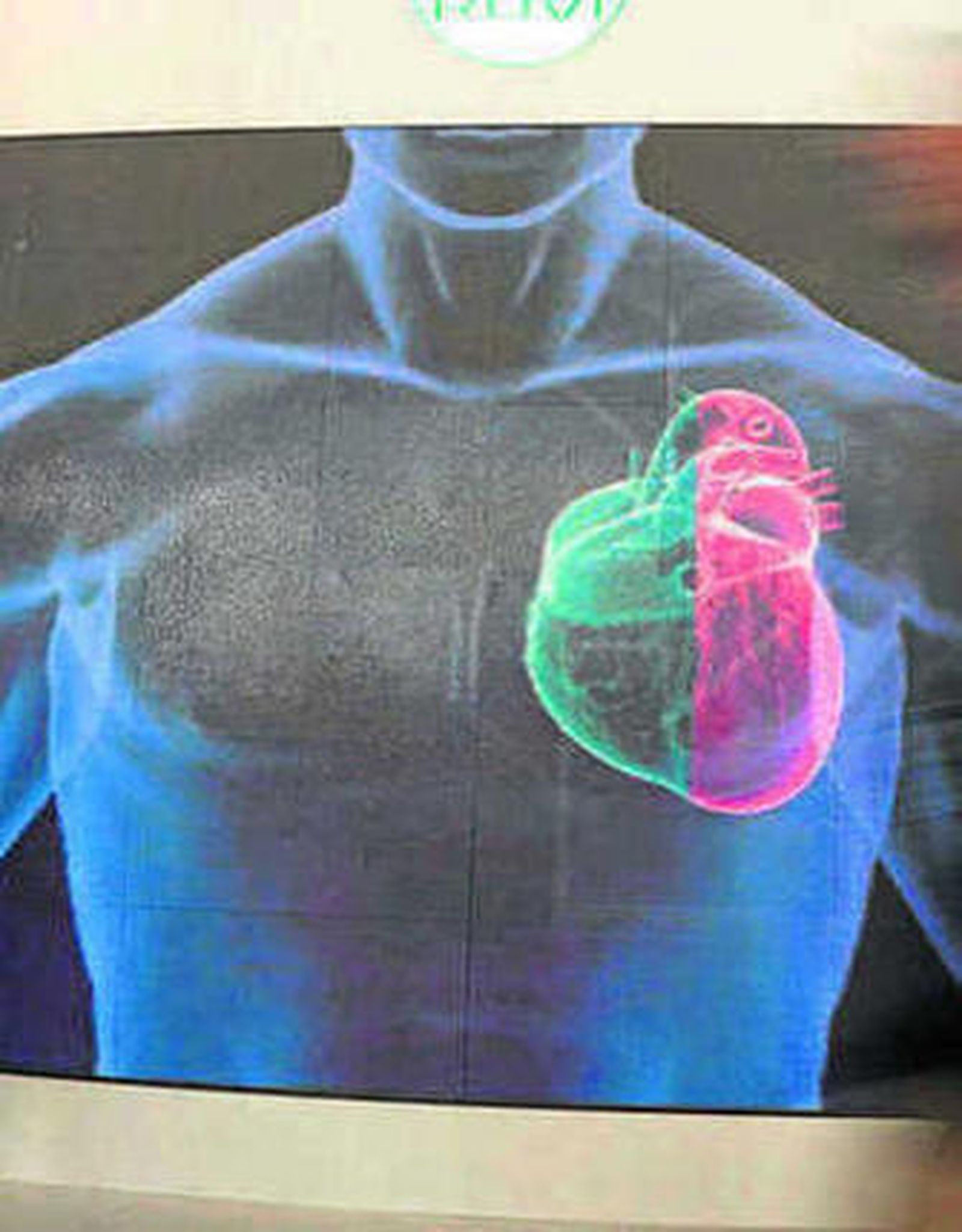 'Cardiolife' llega mañana a Almería.