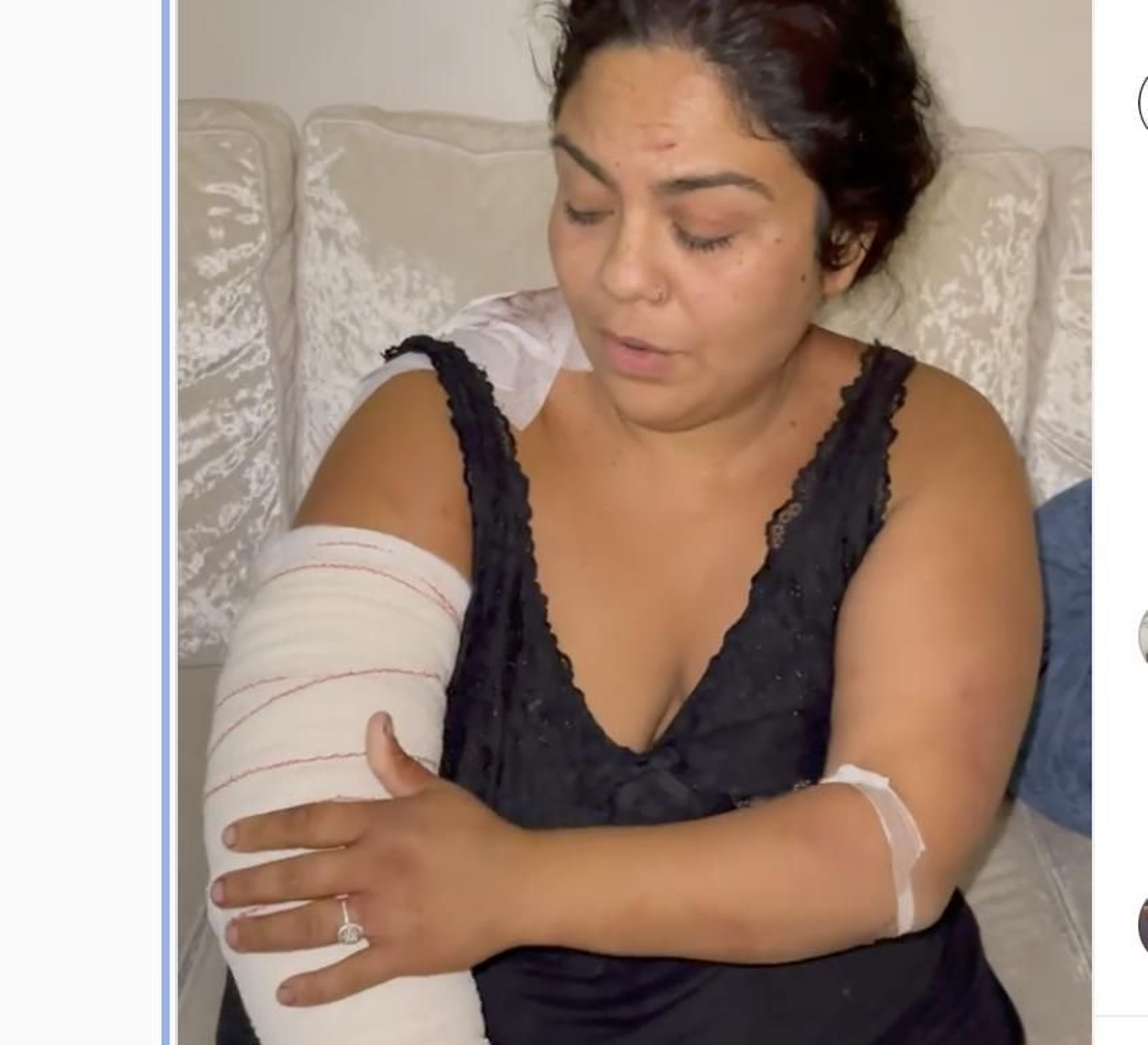 Saray Montoya explica en sus redes sociales las lesiones sufridas