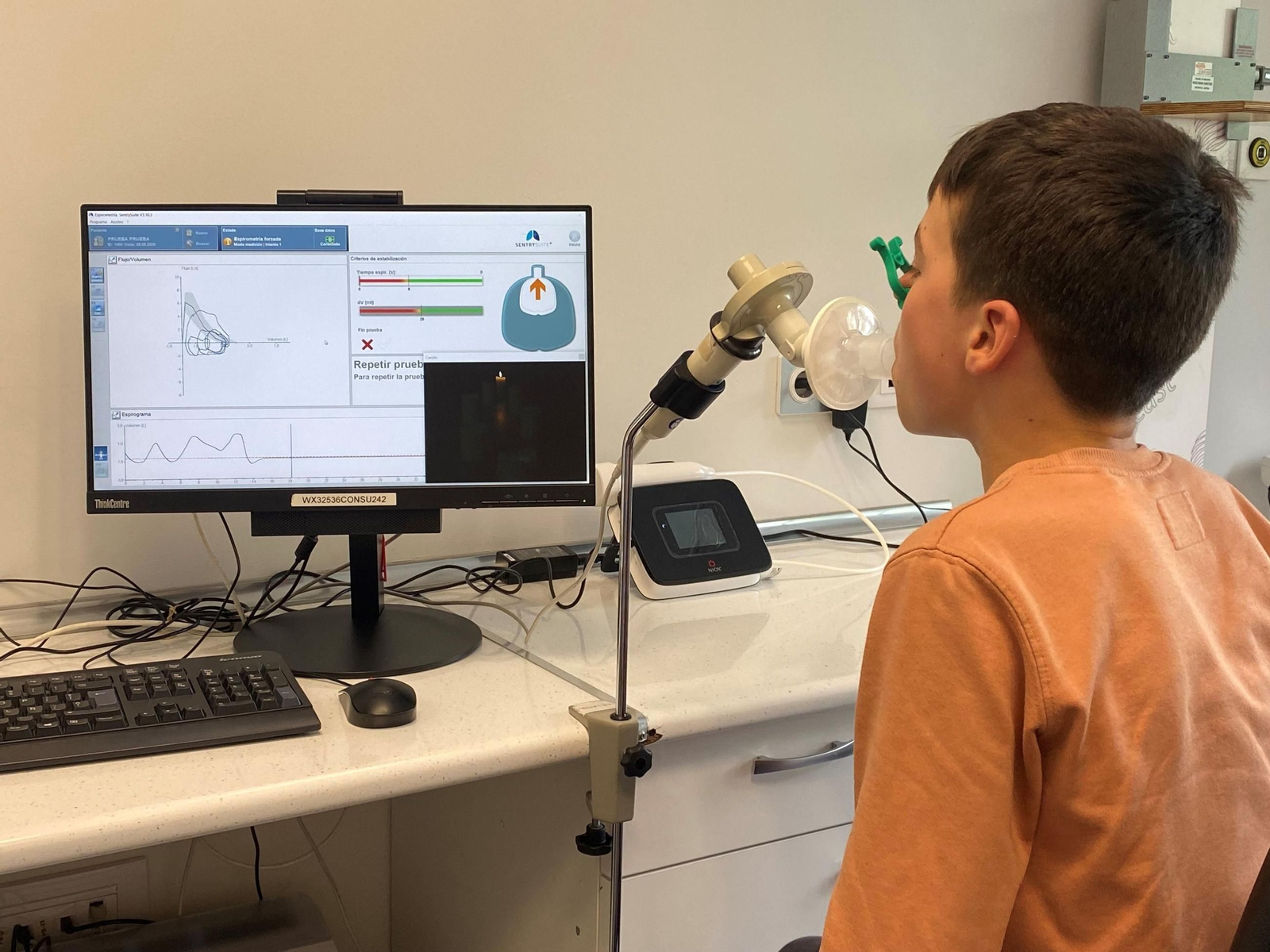 La mitad de los afectados tiene menos de 20 años, lo que pone de relieve el peso del asma infantil y adolescente.