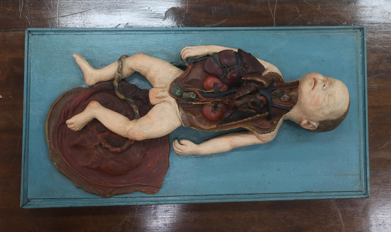 Restauración de esculturas anatómicas usadas con fines docentes entre el siglo XVIII y el XX en la Facultad de Medicina de la US