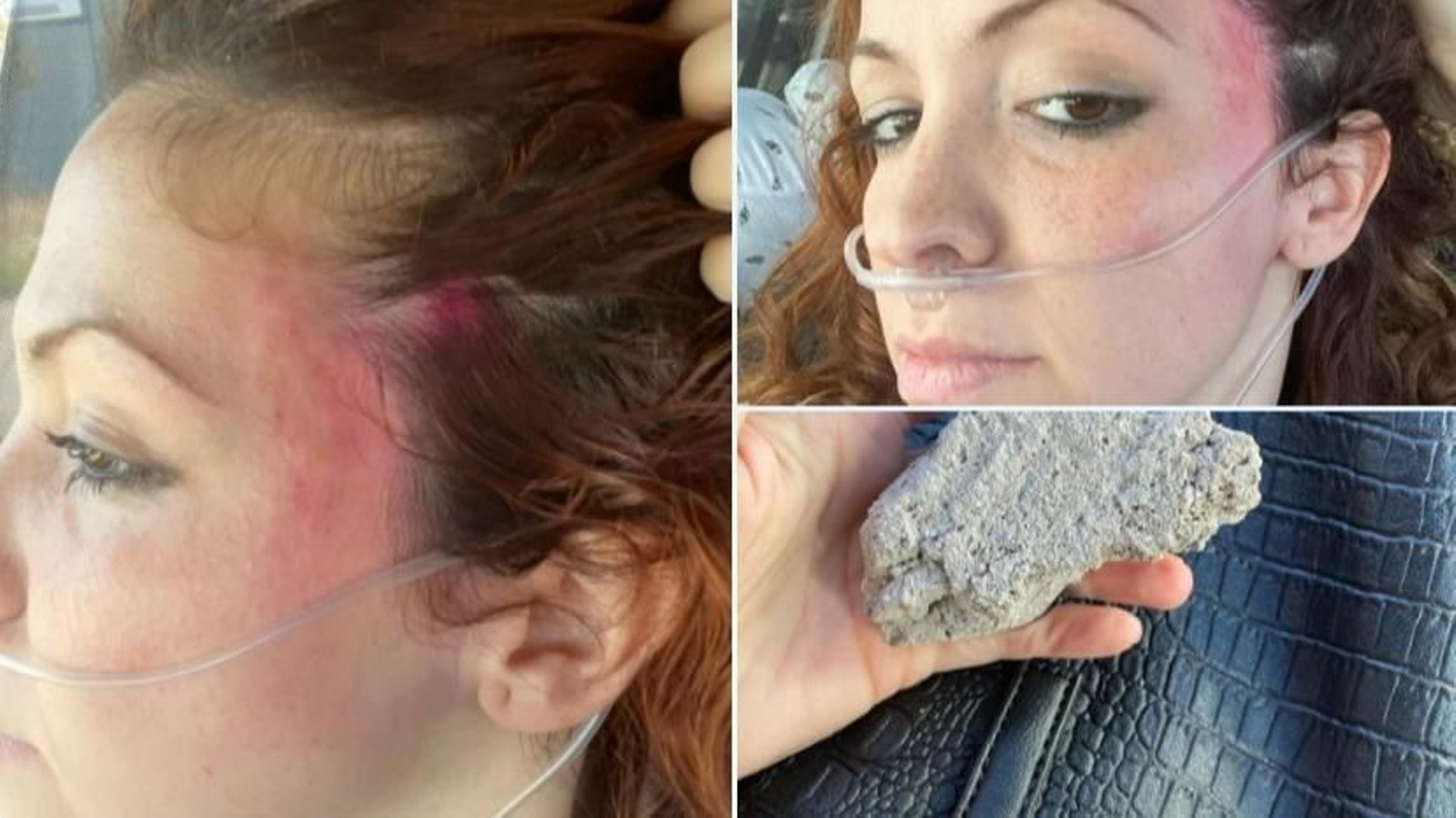 Imágenes de la concejal de distrito Estefanía Martín herida en la cabeza.