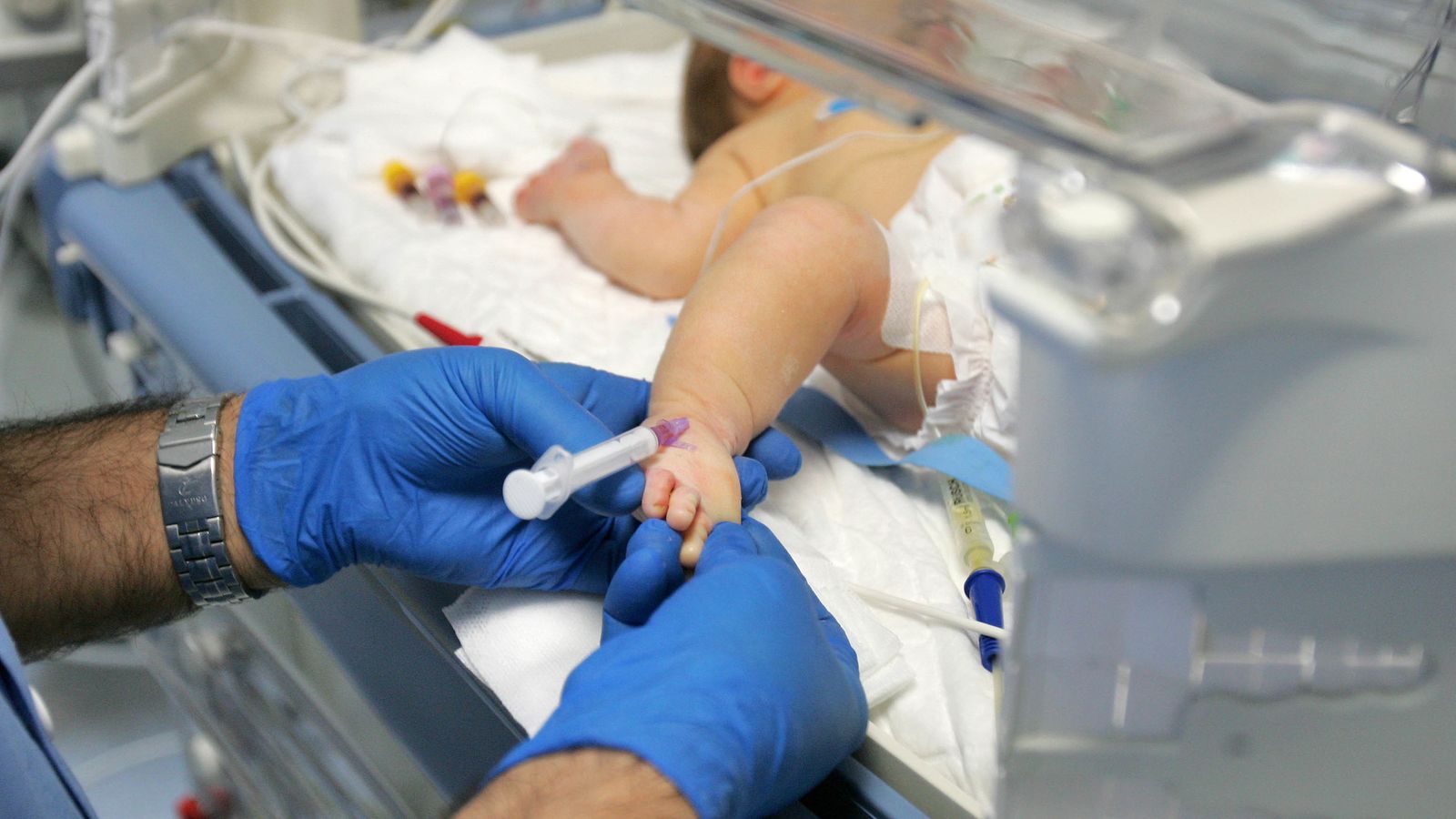 Los nacimientos prematuros suponen un 10% del total, aproximadamente.