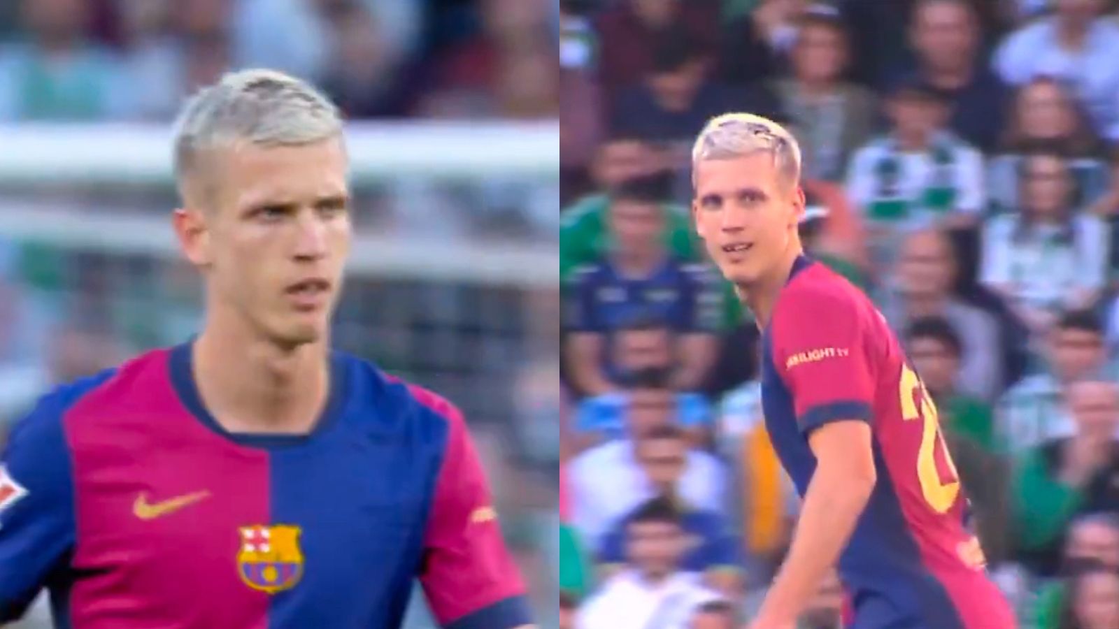 Las imágenes de Dani Olmo tras perder la funda de su diente